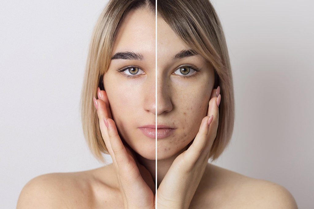 dermatologia