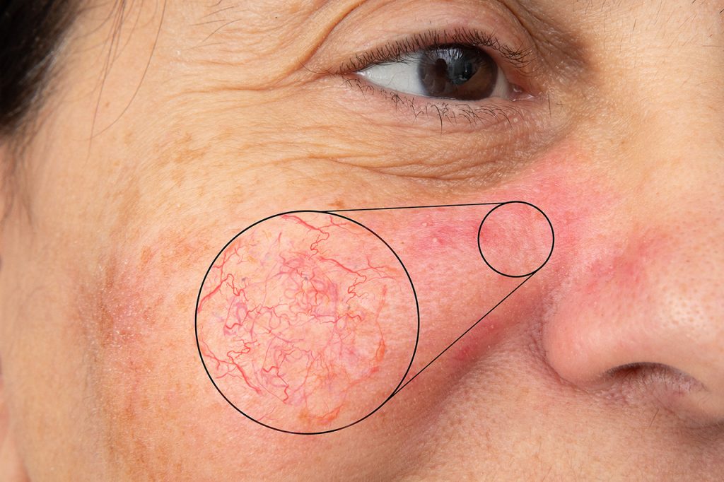 dermatologo