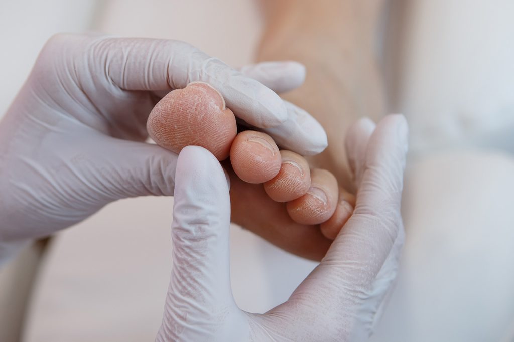 area salud torrevieja podologia