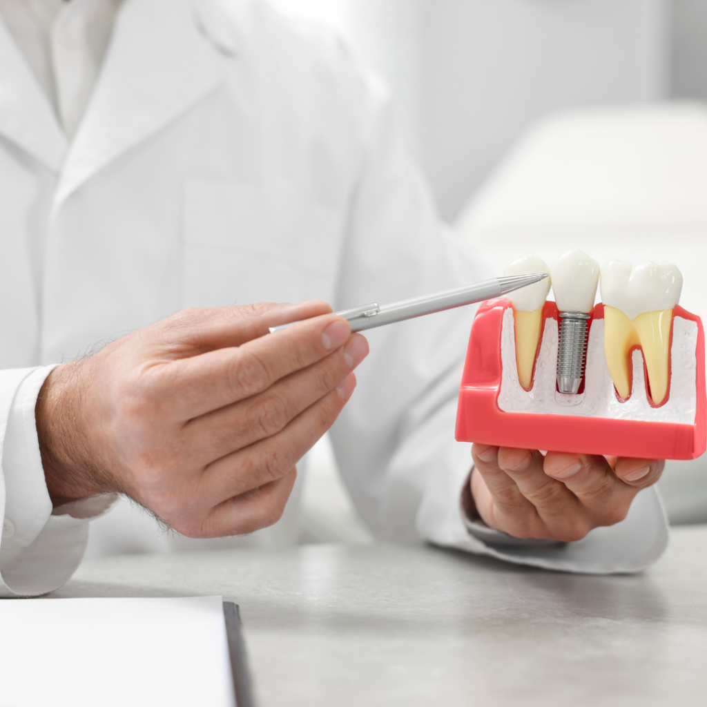 implantes en torrevieja