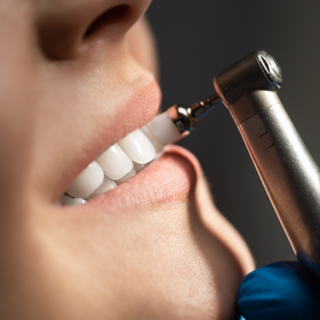 centro para hacer limpieza dental en torrevieja