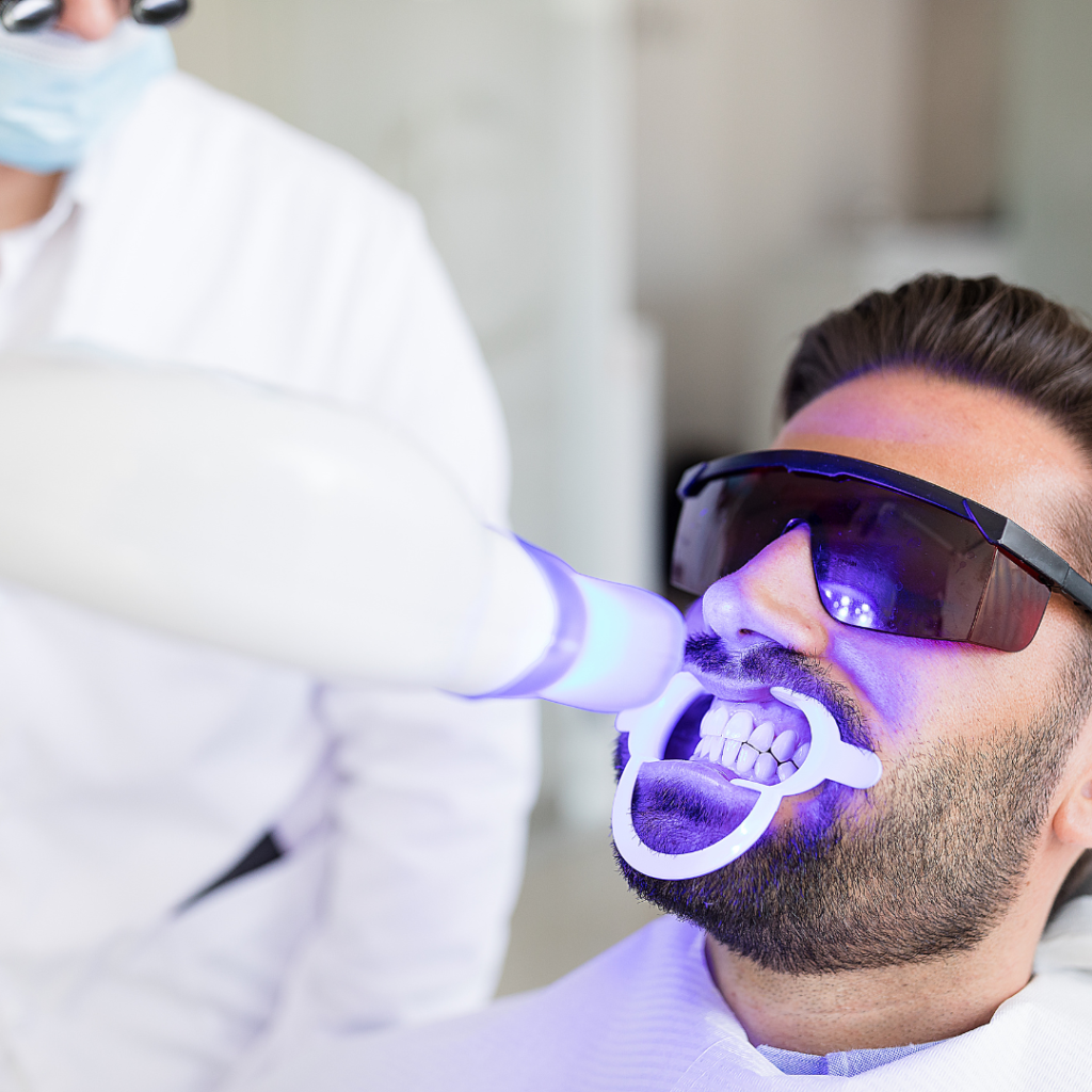 clinica dental blanquear dientes torrevieja