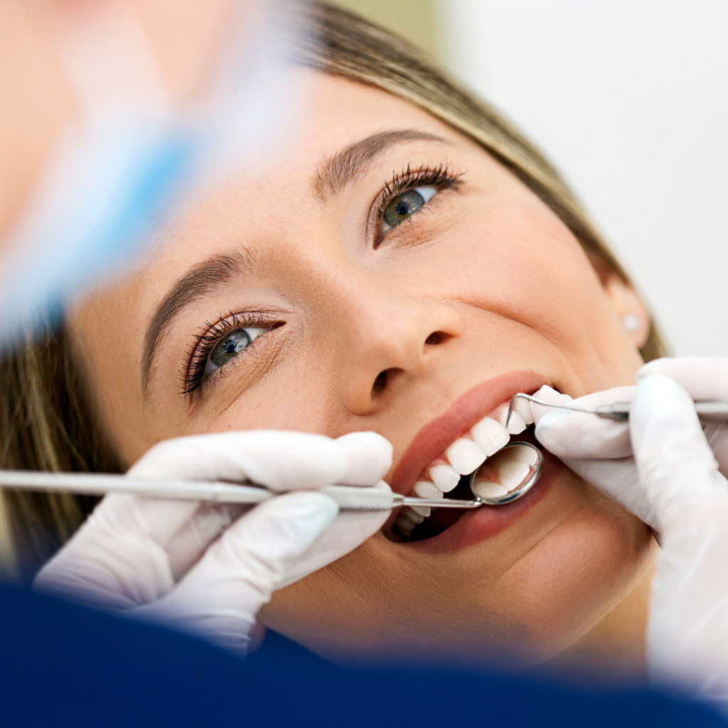 limpieza dental torrevieja