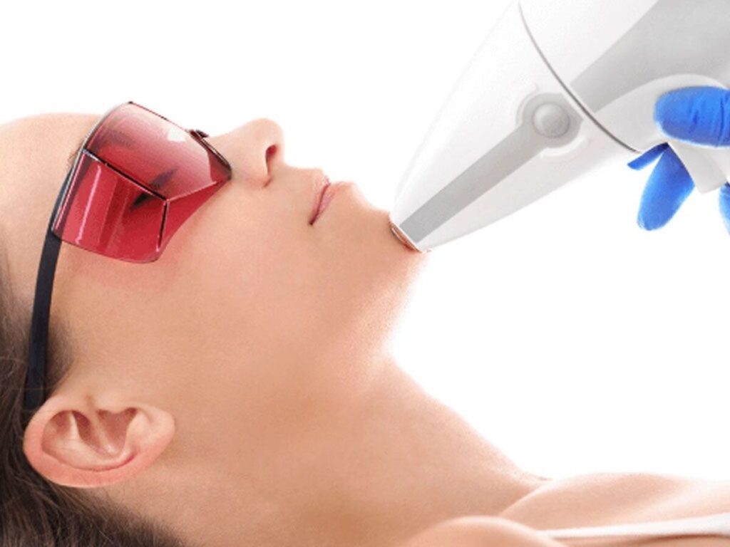 tratamiento laser torrevieja