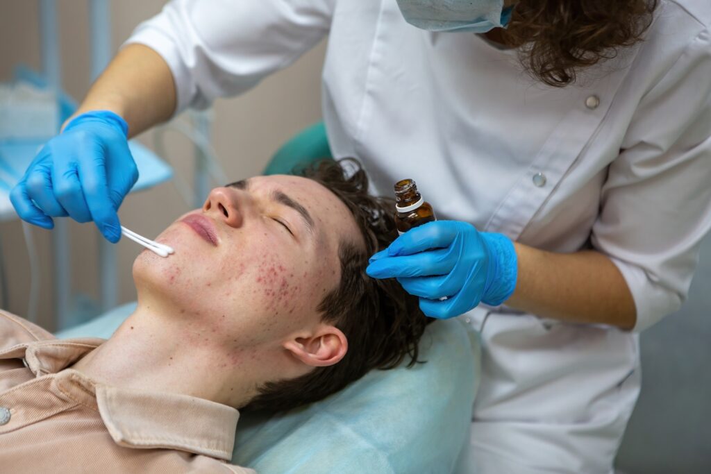 tratamiento-acne-torrevieja