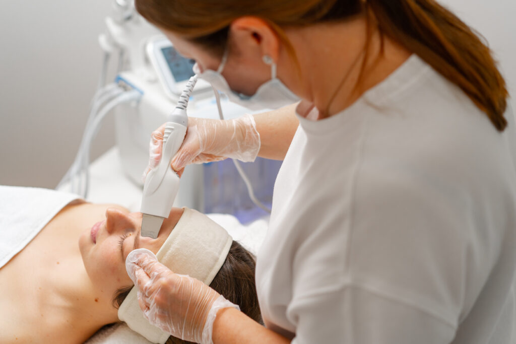 tratamiento-acne-torrevieja