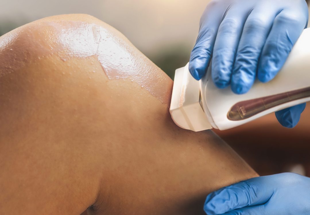 Waxing legs in a beauty salon, wax applicator closeup