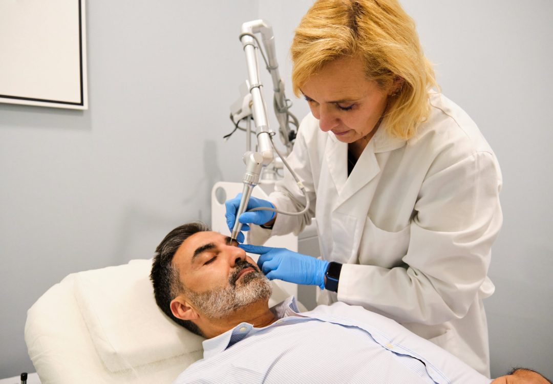 tratamiento-rosacea-torrevieja